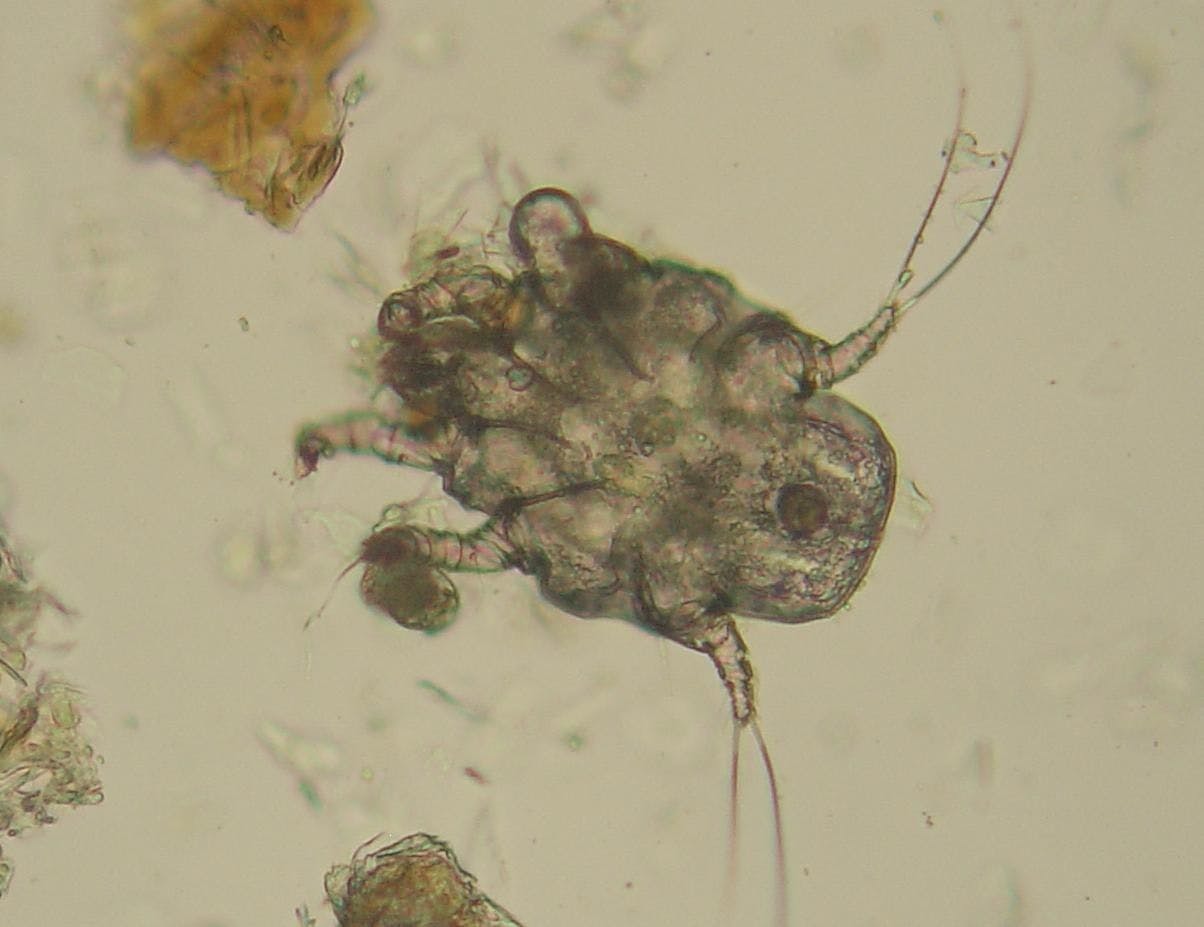 Ear mite in microscope